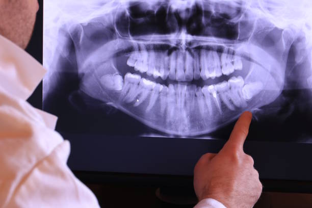 Trusted ND Emergency Dentist Experts